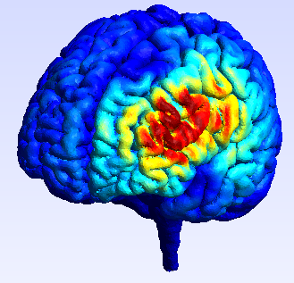 electric_field_distribution_in_transcranial_magnetic_stimulation.png